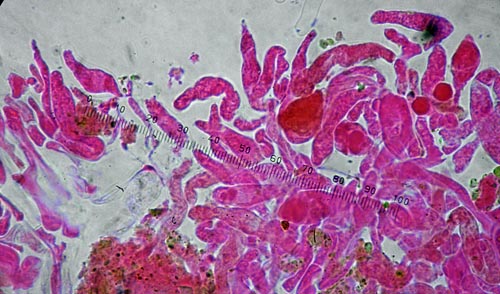 Boletus poikilochromus caulocystidia