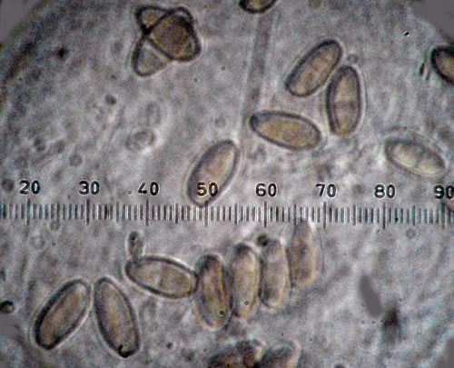 Xerocomus persicolor spores